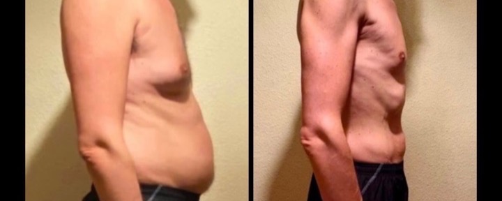 David before and after