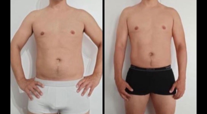 Miguel before and after