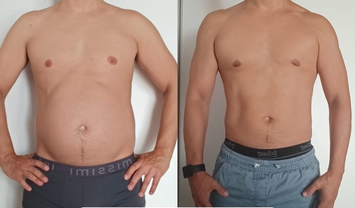 Toni before and after, front view