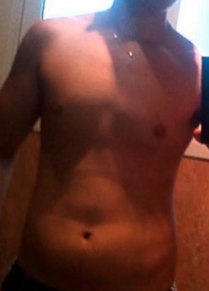 Alberto before, overweight